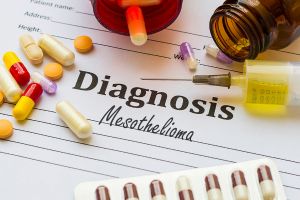 How Pleural Mesothelioma Diagnosis : Comprehensive Guide