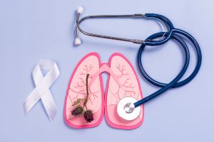 Which Organ Affected By Mesothelioma : Comprehensive Guide